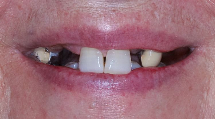 Before - Wash Common Dental