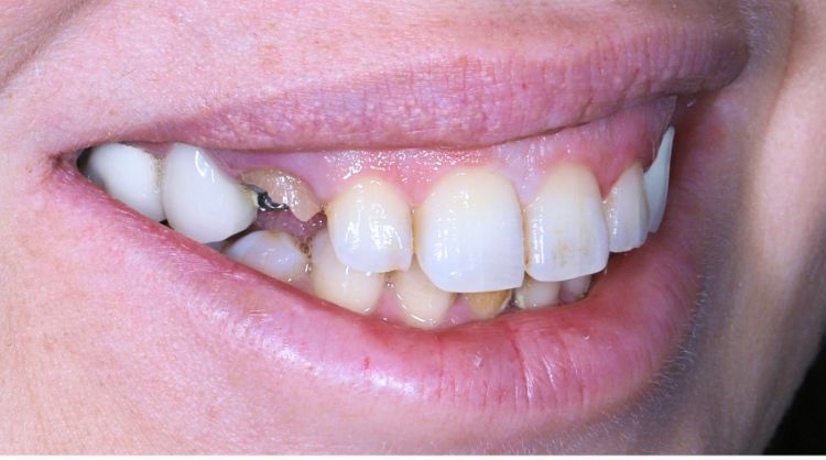 Before - Wash Common Dental