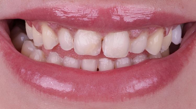Before - Wash Common Dental