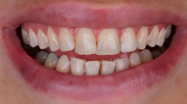 Before - Wash Common Dental