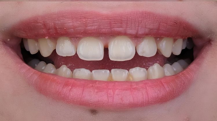 Before - Wash Common Dental